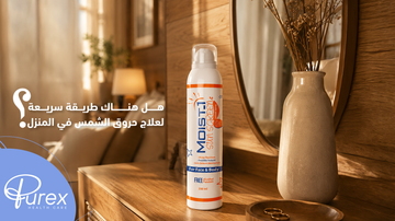 علاج حروق الشمس في المنزل