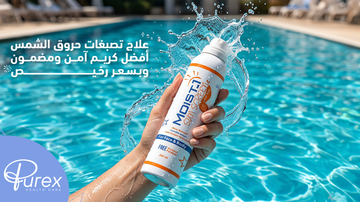 علاج تصبغات حروق الشمس